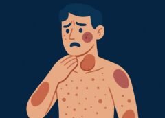 Adult-Onset Immunodeficiency From Anti–Interferon-Gamma Autoantibodies: The Underrecognized Cause of Opportunistic Infections in HIV-Negative Adults